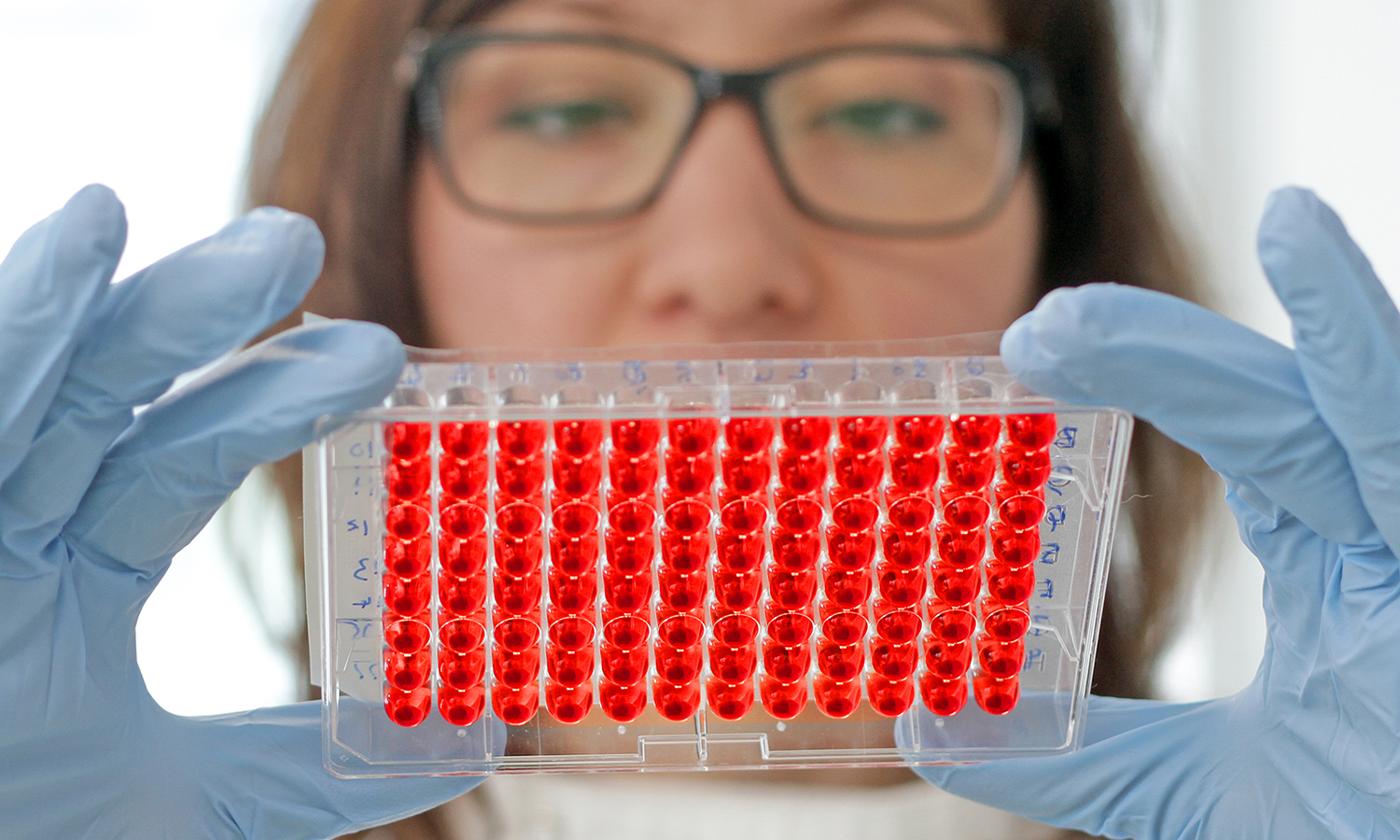 platelet testing